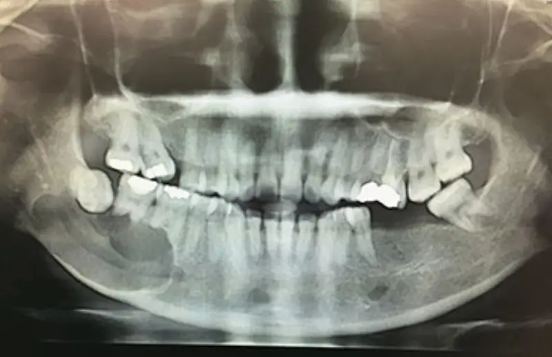 Nöbetçi Dişçi | Sancaktepe - Ümraniye - Üsküdar - Bahçelievler | Özbudent Ağız ve Diş Sağlığı Polikliniği