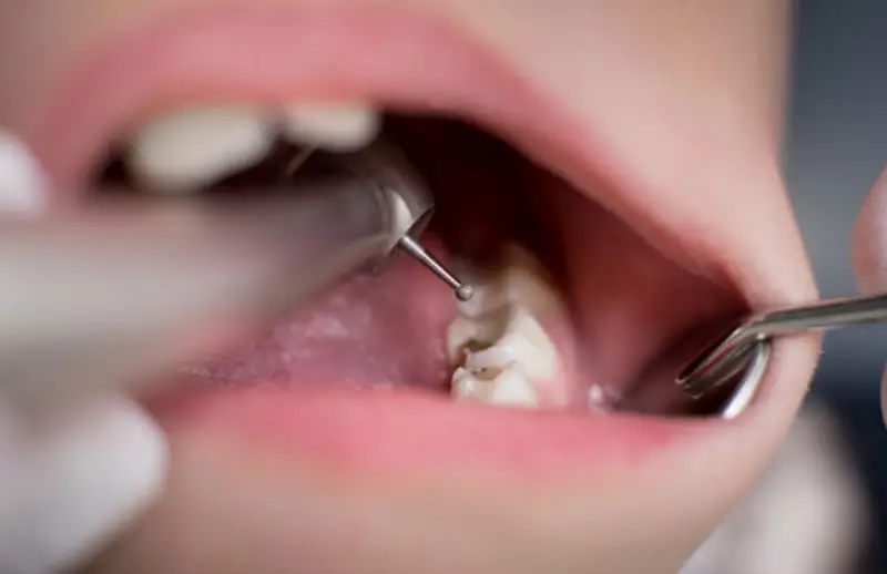 Nöbetçi Dişçi | Sancaktepe - Ümraniye - Üsküdar - Bahçelievler | Özbudent Ağız ve Diş Sağlığı Polikliniği