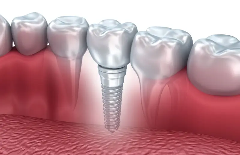 Nöbetçi Dişçi | Sancaktepe - Ümraniye - Üsküdar - Bahçelievler | Özbudent Ağız ve Diş Sağlığı Polikliniği